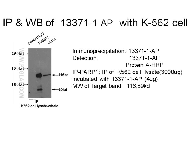 14-3-3 IP 14503-1-AP 14-3-3 Antibody 14-3-3; 1C5; HS1