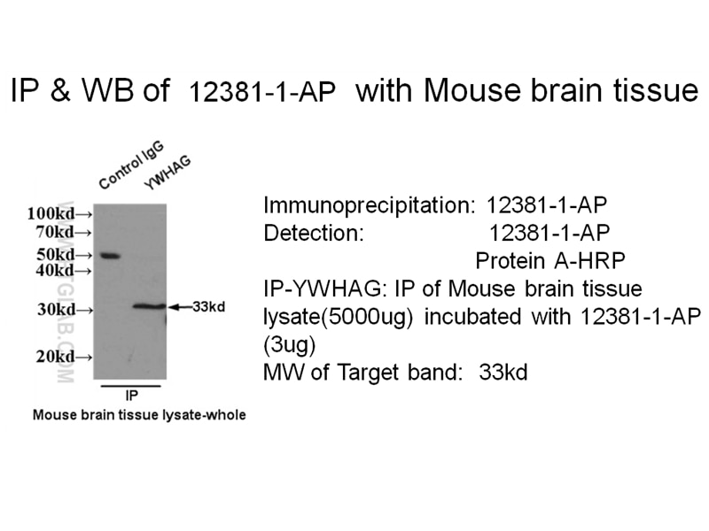 14 3 3GAMMA IP 12381-1-AP 14 3 3GAMMA Antibody 14-3-3GAMMA