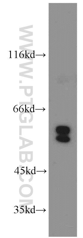 PPP3CC western blot WB 55163-1-AP PPP3CC Antibody CALNA3