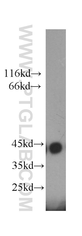 6*his,His tag western blot WB 60001-1-Ig 6*his,His tag Antibody 