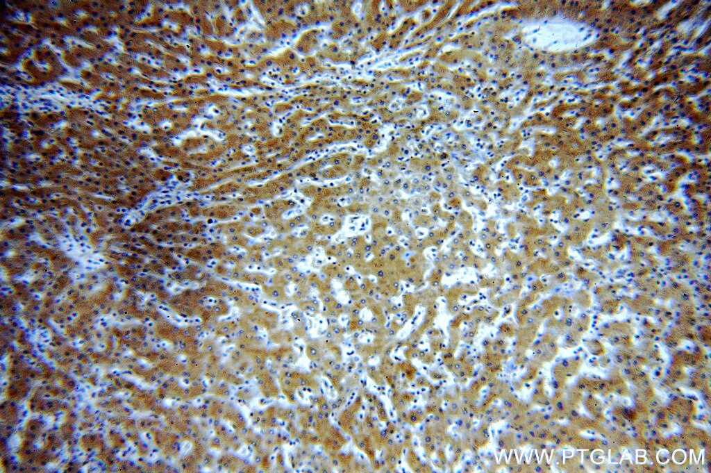 A1BG IHC Immunohistochemical 14181-1-AP A1BG Antibody A1B; ABG; DKFZp686F0970; GAB; HYST2477