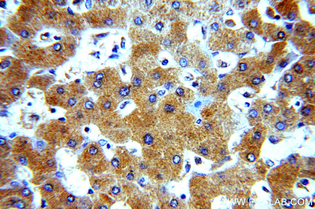 A1BG IHC Immunohistochemical 14181-1-AP A1BG Antibody A1B; ABG; DKFZp686F0970; GAB; HYST2477