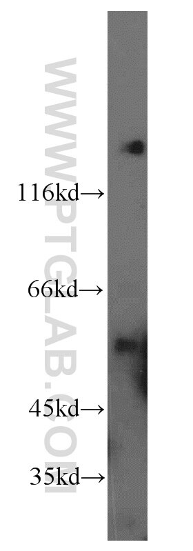 A1BG western blot WB 14181-1-AP A1BG Antibody A1B; ABG; DKFZp686F0970; GAB; HYST2477