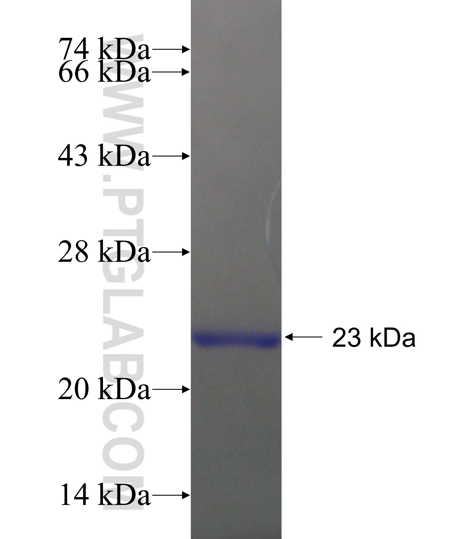 A2LD1 fusion protein ag18549 SDS-PAGE