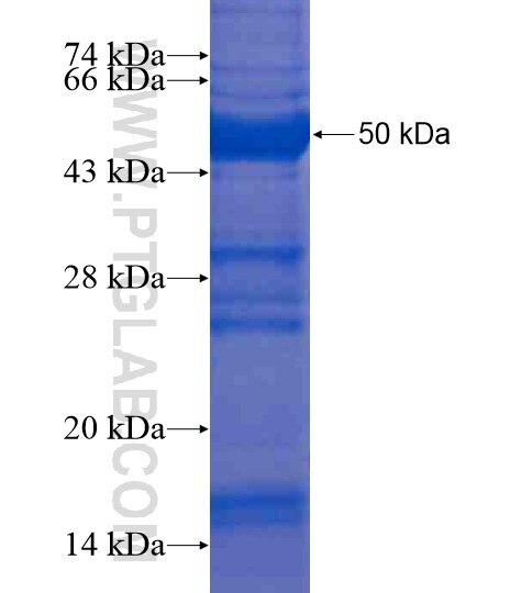 A2M fusion protein ag19245 SDS-PAGE