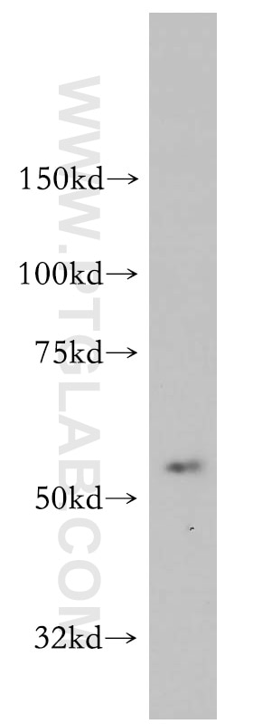AADACL1 western blot WB 14021-1-AP AADACL1 Antibody NCEH