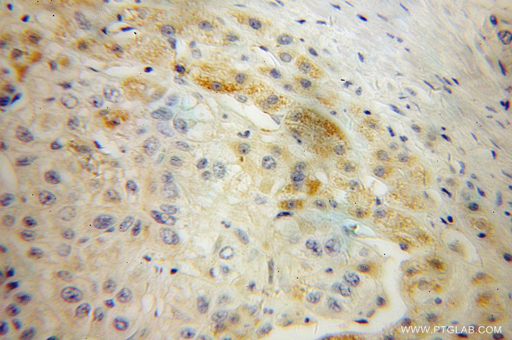 AADAT IHC Immunohistochemical 13031-1-AP AADAT Antibody KAT2; KATII