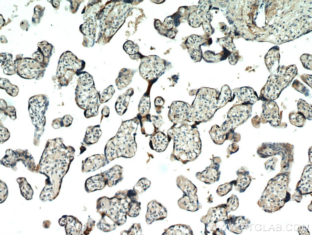AAMP IHC Immunohistochemical 21220-1-AP AAMP Antibody 