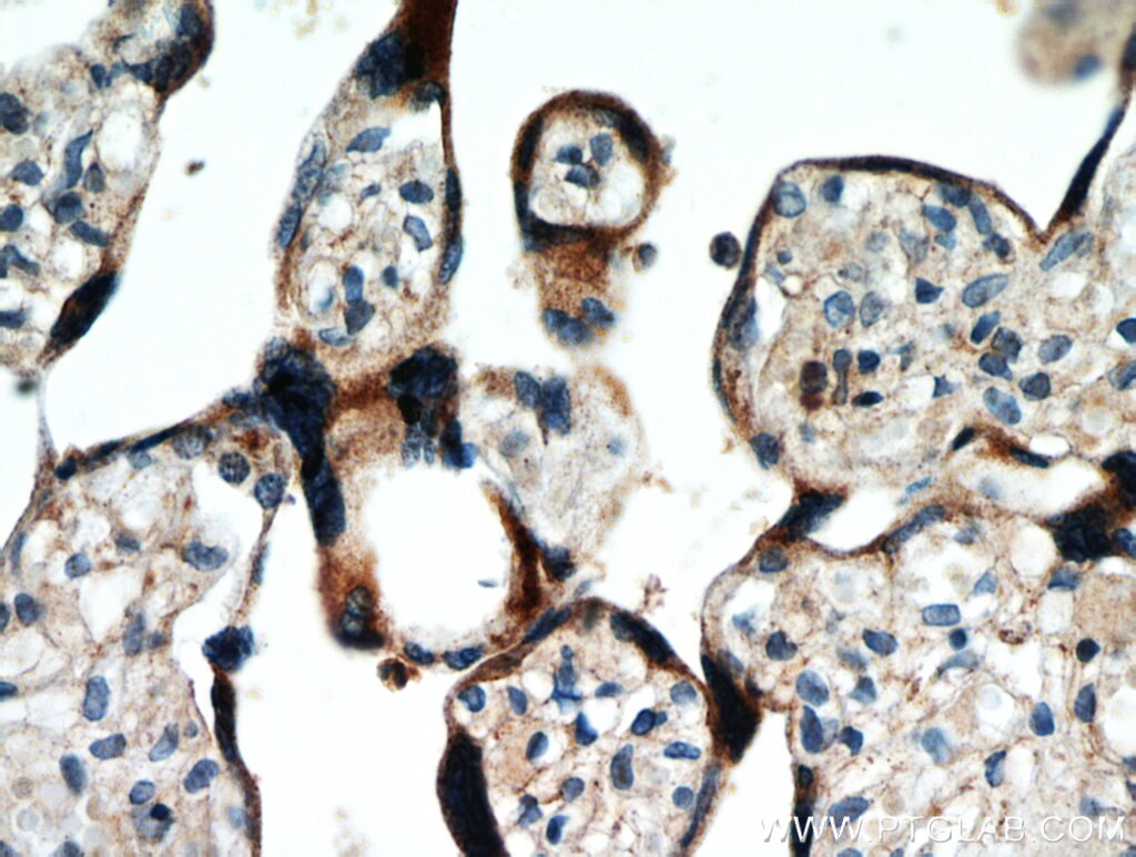 AAMP IHC Immunohistochemical 21220-1-AP AAMP Antibody 