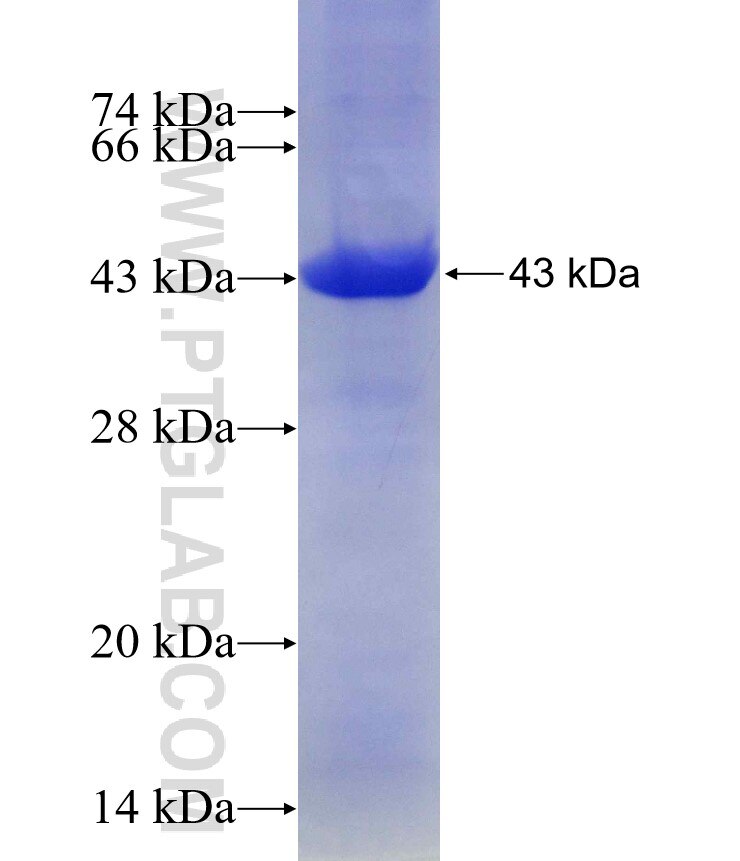 AAMP fusion protein ag15861 SDS-PAGE