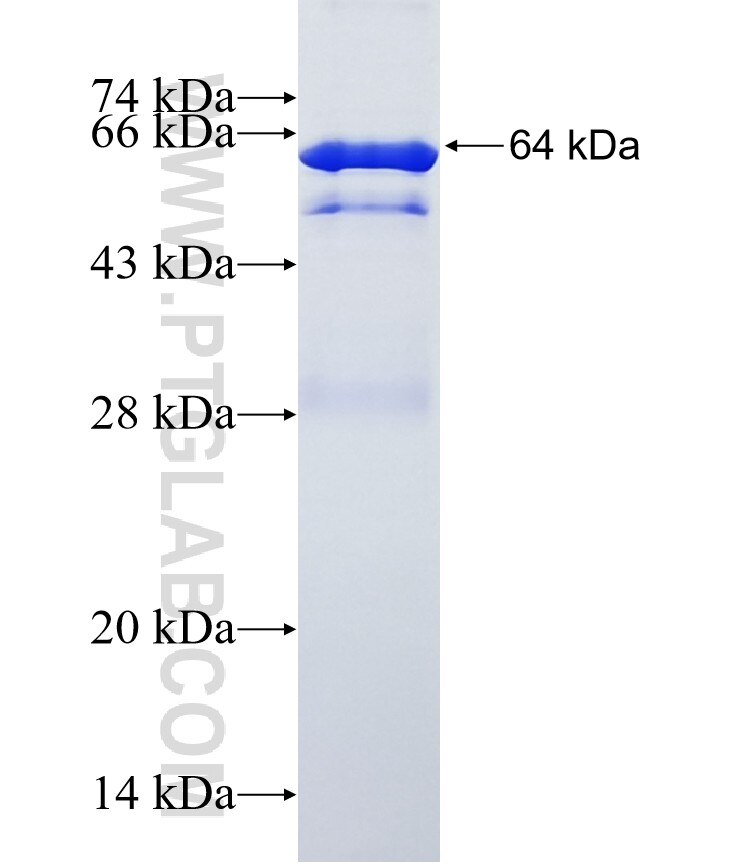 AARS fusion protein ag11294 SDS-PAGE