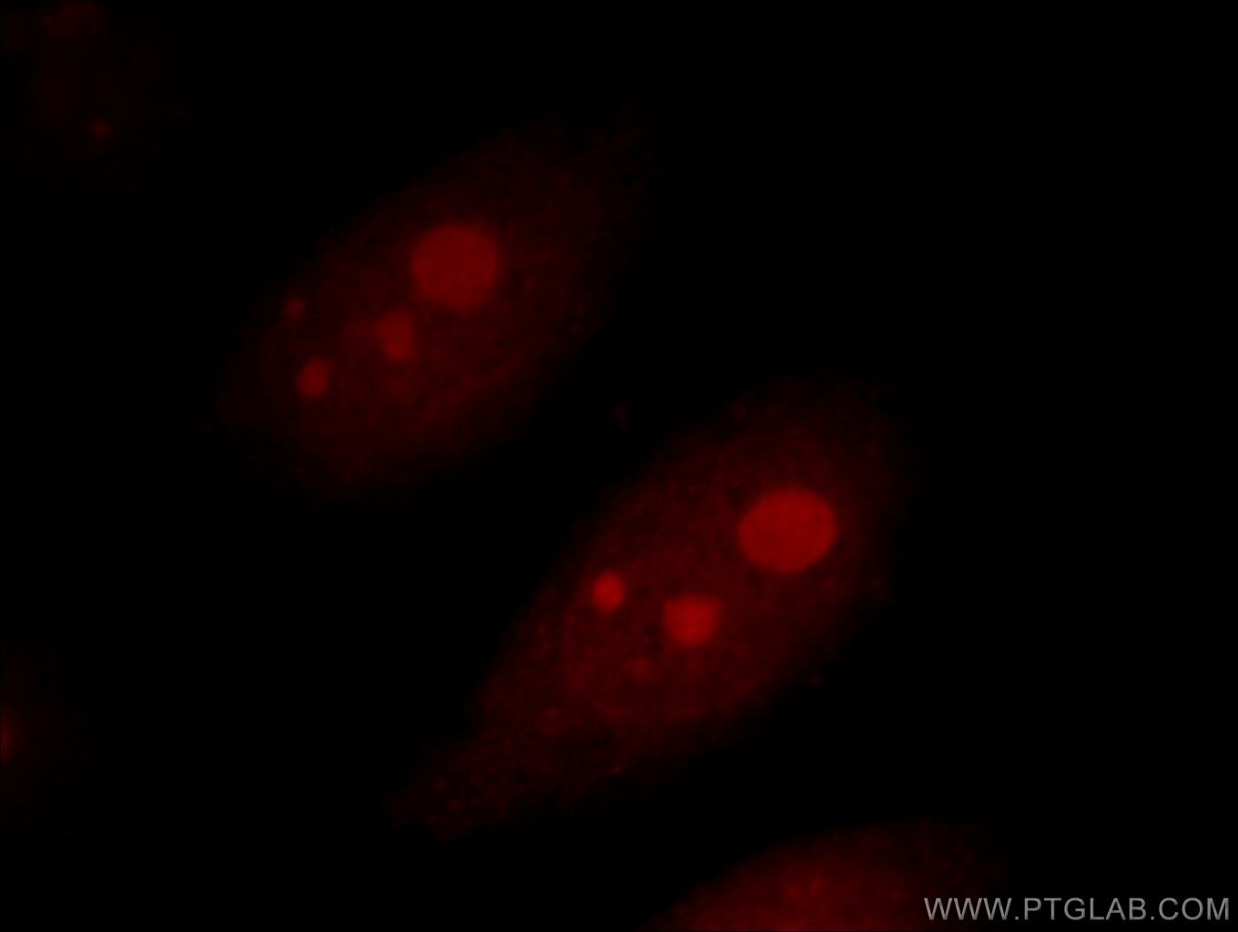 Immunofluorescent analysis of Hela cells, using AATF antibody 10282-1-AP at 1:25 dilution and Rhodamine-labeled goat anti-rabbit IgG (red). AATF Immunofluorescence IF 10282-1-AP AATF Antibody CHE-1; CHE1; DED