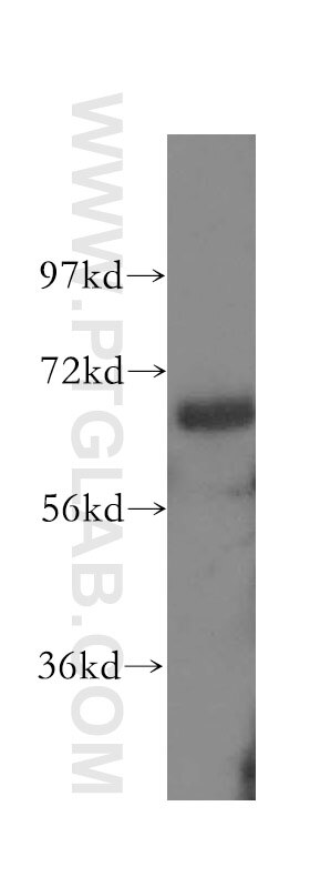 mouse brain tissue were subjected to SDS PAGE followed by western blot with 10282-1-AP(AATF Antibody) at dilution of 1:800 AATF western blot WB 10282-1-AP AATF Antibody CHE-1; CHE1; DED