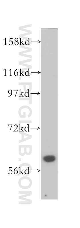 ABCB10 western blot WB 14628-1-AP ABCB10 Antibody EST20237; M-ABC2; MTABC2