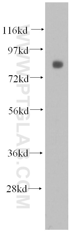 Raji cells were subjected to SDS PAGE followed by western blot with 51007-1-AP(ABCB6 Antibody) at dilution of 1:1000 ABCB6 western blot WB 51007-1-AP ABCB6 Antibody ABC; ABC14; EST45597; FLJ22414; MTABC3; PRP; umat
