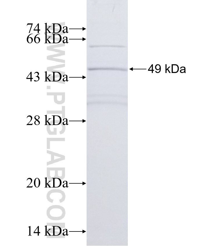 ABCB6 fusion protein ag0461 SDS-PAGE
