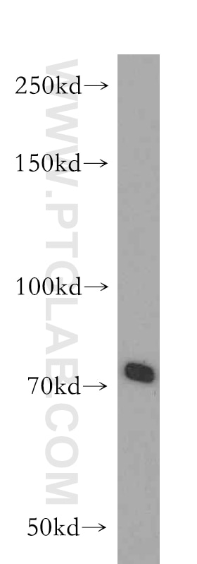 ABCB9 western blot WB 11066-1-AP ABCB9 Antibody EST122234; KIAA1520; TAPL