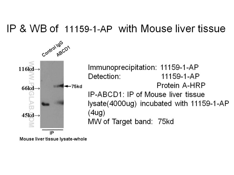 ABCD1 IP 11159-1-AP ABCD1 Antibody ABC42; ALD; ALDP; AMN