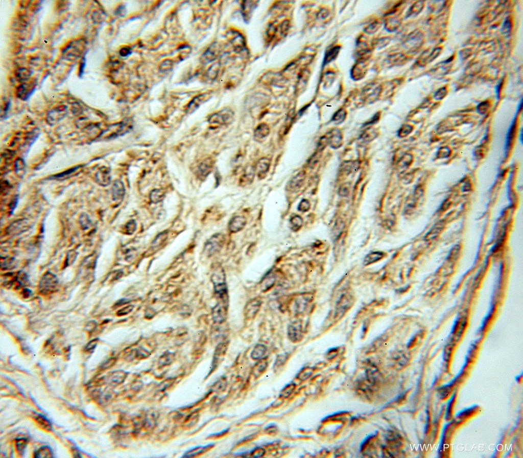 ABCE1 IHC Immunohistochemical 51008-2-AP ABCE1 Antibody ABC38; OABP; RLI; RNASEL1; RNASELI; RNS4I