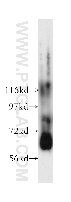 ABCE1 western blot WB 51008-2-AP ABCE1 Antibody ABC38; OABP; RLI; RNASEL1; RNASELI; RNS4I