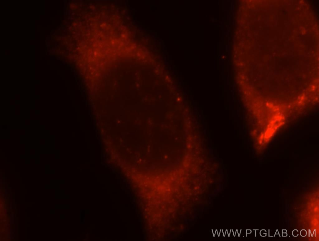 Immunofluorescent analysis of MCF-7 cells, using ABHD5 antibody 12201-1-AP at 1:25 dilution and Rhodamine-labeled goat anti-rabbit IgG (red). ABHD5 Immunofluorescence IF 12201-1-AP ABHD5 Antibody CDS; CGI58; IECN2; MGC8731; NCIE2