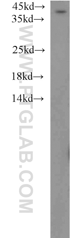 Jurkat cells were subjected to SDS PAGE followed by western blot with 12201-1-AP(ABHD5 Antibody) at dilution of 1:500 ABHD5 western blot WB 12201-1-AP ABHD5 Antibody CDS; CGI58; IECN2; MGC8731; NCIE2