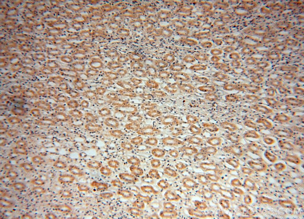 ACADL IHC Immunohistochemical 17442-1-AP ACADL Antibody ACAD4; FLJ94052; LCAD