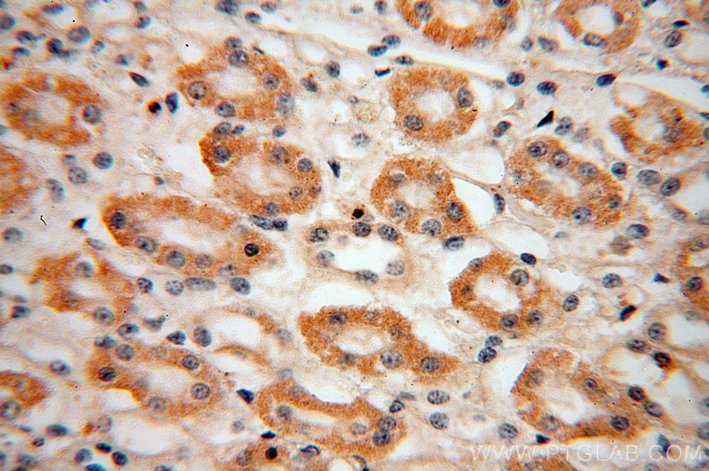 ACADL IHC Immunohistochemical 17442-1-AP ACADL Antibody ACAD4; FLJ94052; LCAD