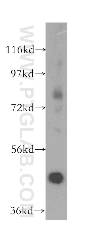 mouse kidney tissue were subjected to SDS PAGE followed by western blot with 17526-1-AP(ACADL-Specific Antibody) at dilution of 1:600 ACADL-Specific western blot WB 17526-1-AP ACADL-Specific Antibody ACAD4; FLJ94052; LCAD