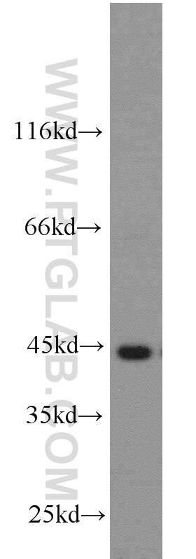ACADM western blot WB 55210-1-AP ACADM Antibody ACAD1; FLJ18227; FLJ93013; FLJ99884; MCAD; MCADH