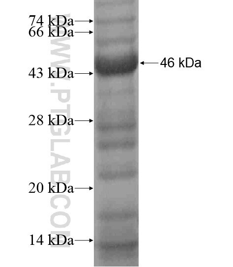 ACCN5 fusion protein ag18835 SDS-PAGE