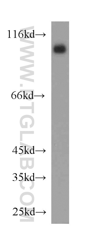 ACE2 western blot WB 21115-1-AP ACE2 Antibody ACEH; DKFZp434A014