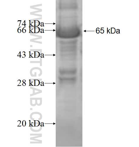 ACOT7 fusion protein ag8759 SDS-PAGE