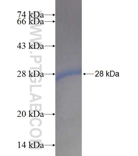 ACOT9 fusion protein ag8884 SDS-PAGE