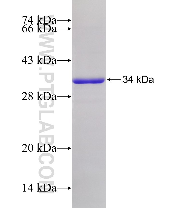 ACSBG2 fusion protein ag5183 SDS-PAGE