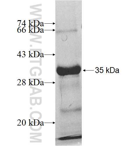 ACSF2 fusion protein ag9309 SDS-PAGE