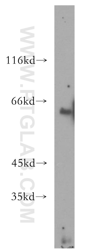 ACSM3 western blot WB 10168-2-AP ACSM3 Antibody SA; SAH