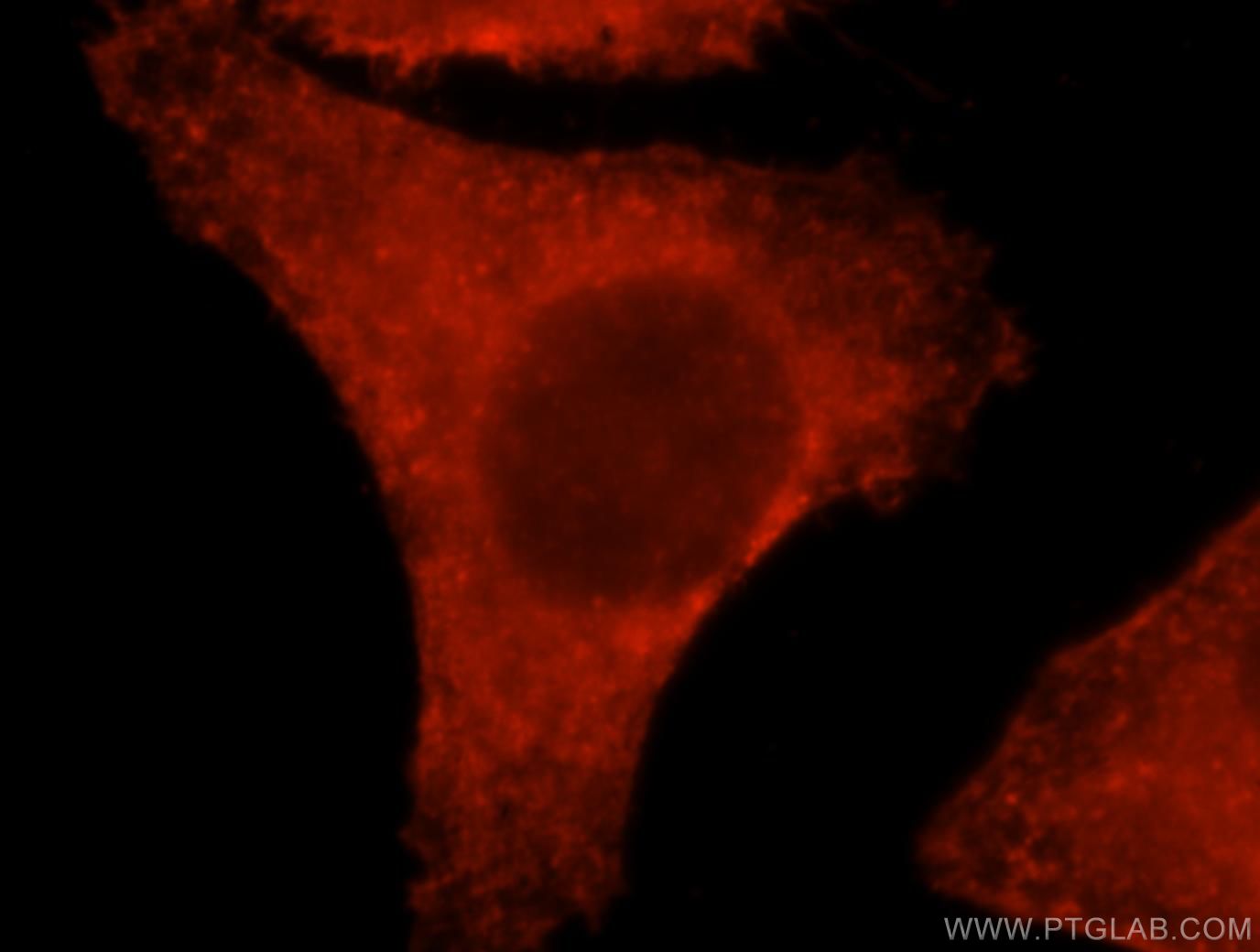 ACTB Immunofluorescence IF 20536-1-AP ACTB Antibody PS1TP5BP1