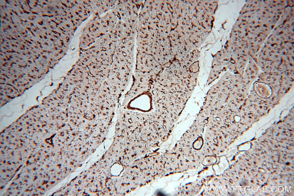 ACTB IHC Immunohistochemical 20536-1-AP ACTB Antibody PS1TP5BP1