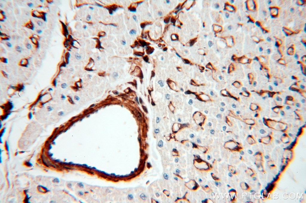 ACTB IHC Immunohistochemical 20536-1-AP ACTB Antibody PS1TP5BP1