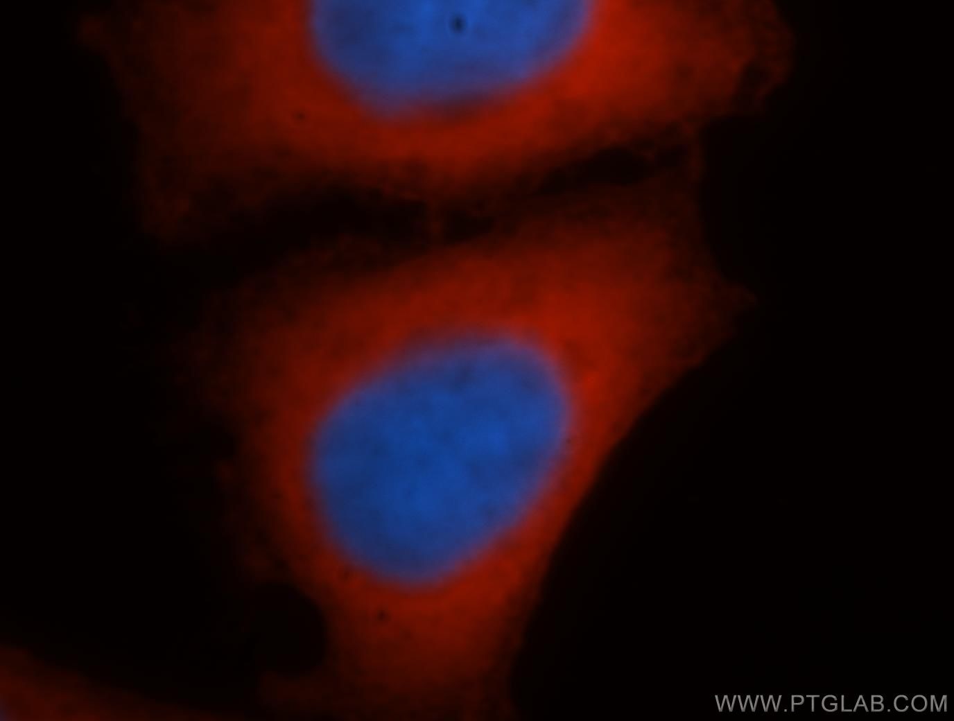 ACTB Immunofluorescence IF 60008-1-Ig ACTB Antibody PS1TP5BP1