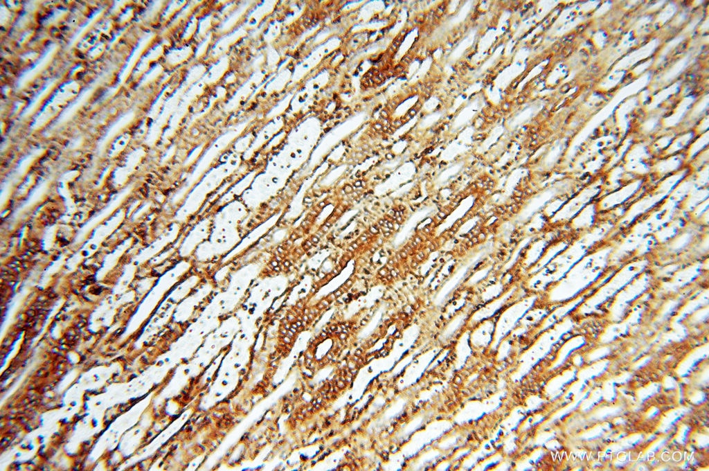 ACTB IHC Immunohistochemical 60008-1-Ig ACTB Antibody ACTB;PS1TP5BP1 ;beta-actin; β-actin