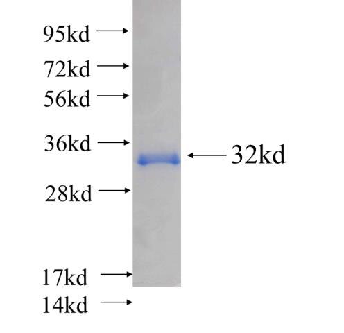 ACTB fusion protein ag14521 SDS-PAGE
