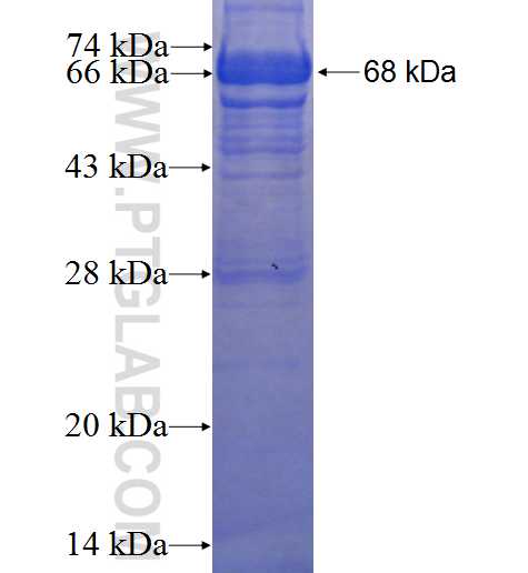 ACTC1 fusion protein ag1471 SDS-PAGE