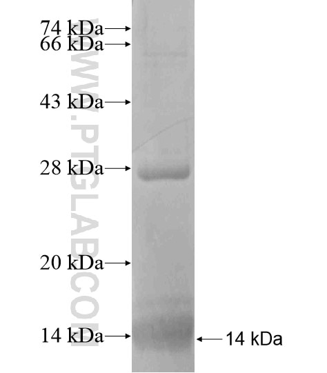 ACTC1 fusion protein ag19477 SDS-PAGE