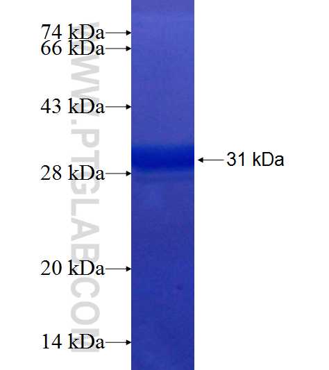 ACTC1 fusion protein ag19482 SDS-PAGE