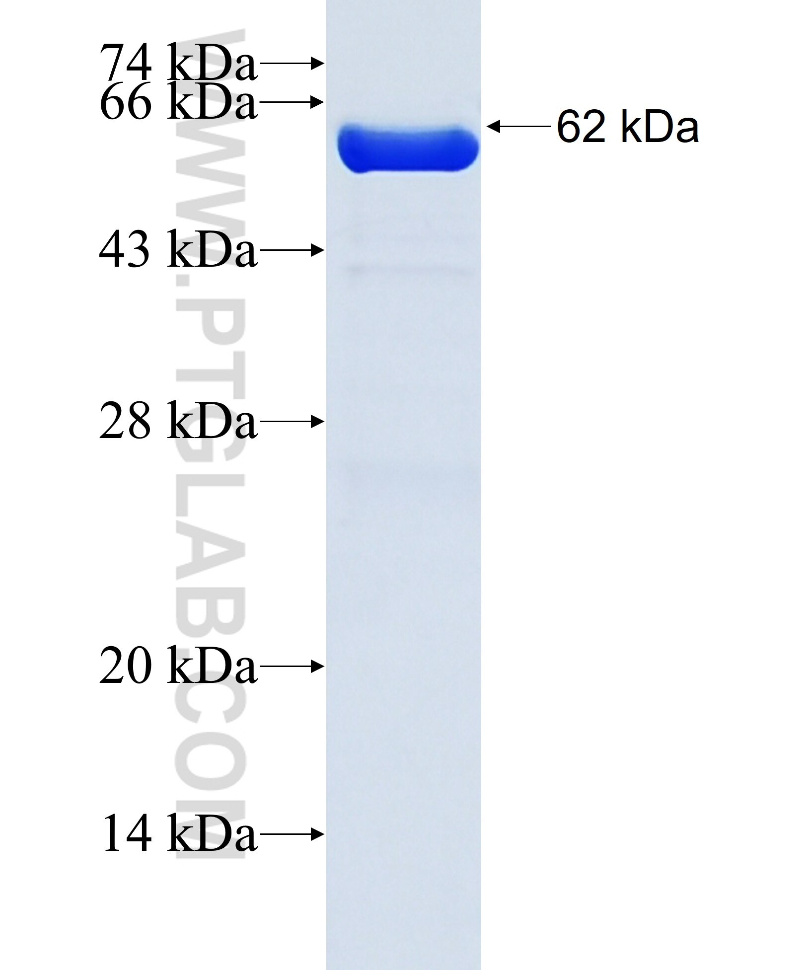ACTN1 fusion protein ag1859 SDS-PAGE