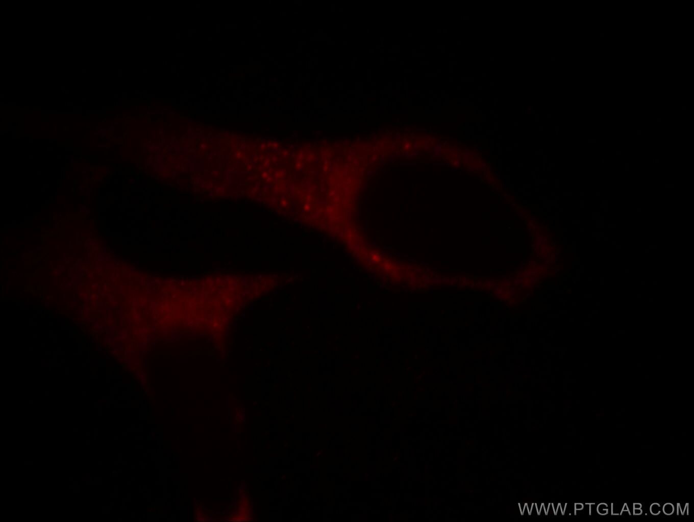 ACVR1 Immunofluorescence IF 60014-1-Ig ACVR1 Antibody ACTRI; ACVR1A; ACVRLK2; ALK2; FOP; SKR1; TSRI