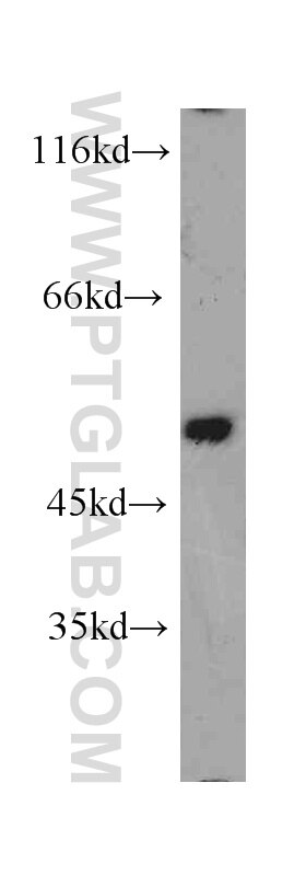 ACVR1 western blot WB 60014-1-Ig ACVR1 Antibody ACTRI; ACVR1A; ACVRLK2; ALK2; FOP; SKR1; TSRI