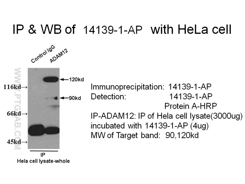 ADAM12 IP 14139-1-AP ADAM12 Antibody MCMP; MCMPMltna; MLTN; MLTNA
